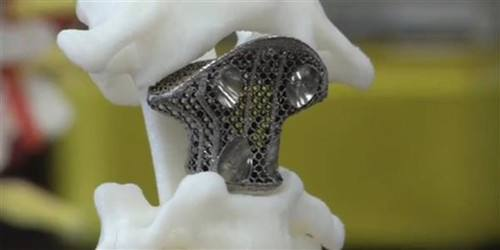 手术中3d的应用