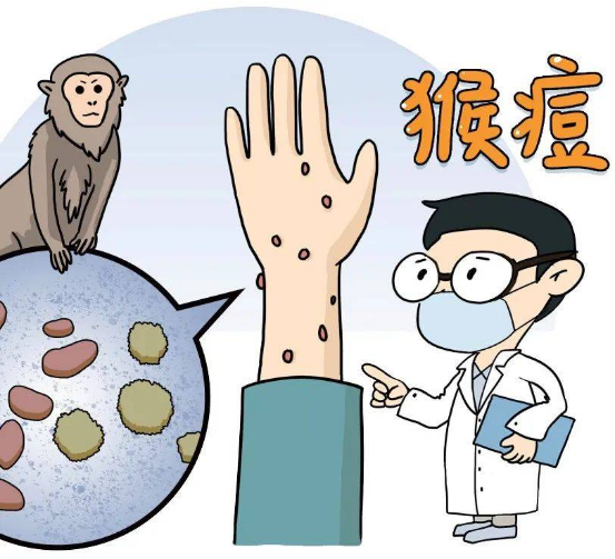 猴痘病毒