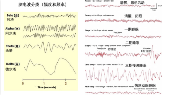 睡眠瘫痪症