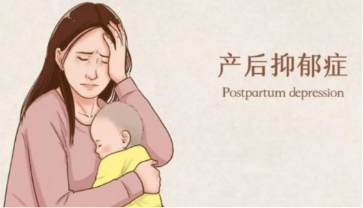 产后抑郁