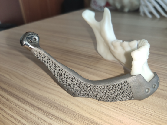 3D打印骨支架