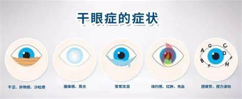 干眼症——现代社会的“隐形流行病”‌