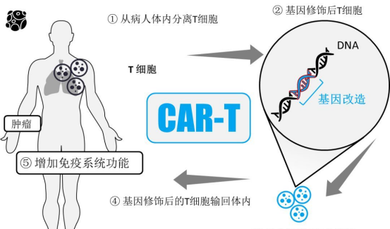 CAR-T如何成为复发防控的“守门员”