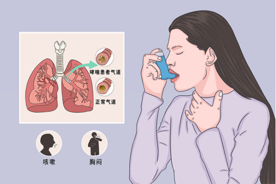国内哮喘防治现状