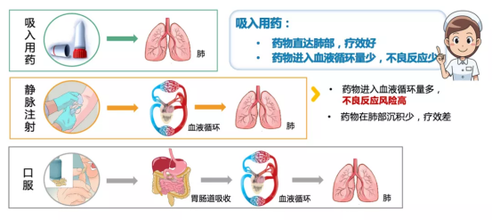 吸入治疗普及的深层障碍与破解之道