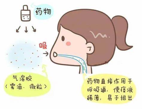 雾化治疗在哮喘管理中的核心地位