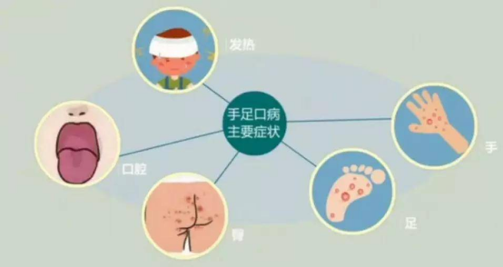 手足口病的流行病学特征与危害
