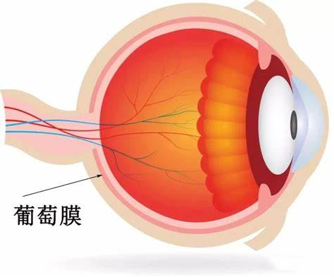 隐匿性后葡萄膜炎的特点与危害