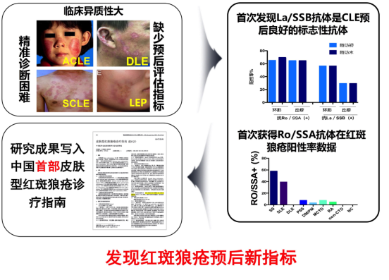 多学科诊疗：系统性红斑狼疮诊疗的新模式