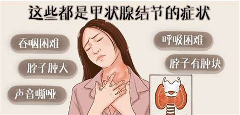 甲状腺结节的成因与风险因素