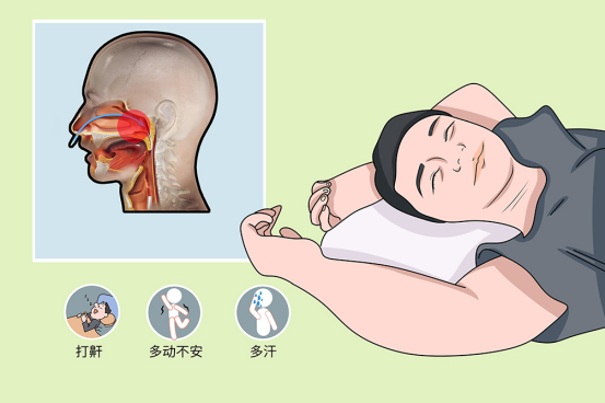 全国睡眠呼吸暂停综合征患病情况