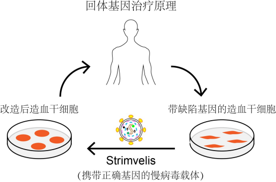 基因编辑技术引领免疫缺陷症治疗新时代