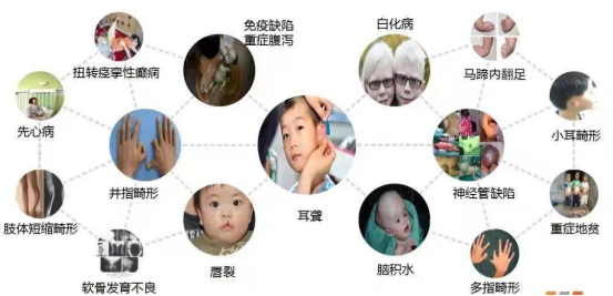 罕见病数据库建设的未来展望