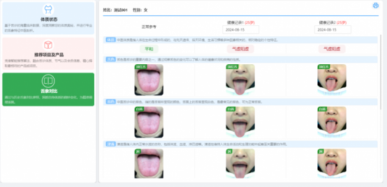 AI舌诊仪的应用现状与发展前景