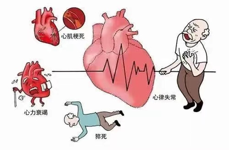 周五晚上心脏病的预防策略：从个体到社会的综合干预